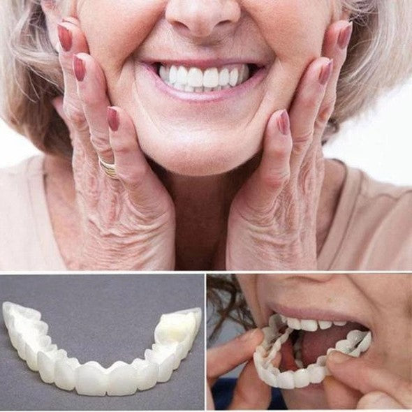 Gros plan sur les facettes dentaires SMILELUX: design fin pour un ajustement parfait et un sourire éclatant.