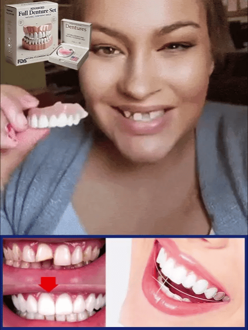 Prothèse dentaire amovible réutilisable pour un sourire naturel, confort supérieur et hygiène facile.
