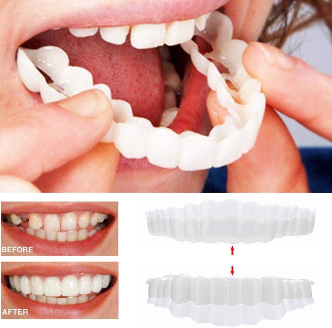 Facettes SMILELUX pour un sourire radieux et une esthétique dentaire parfaite. Blanchiment et confiance.