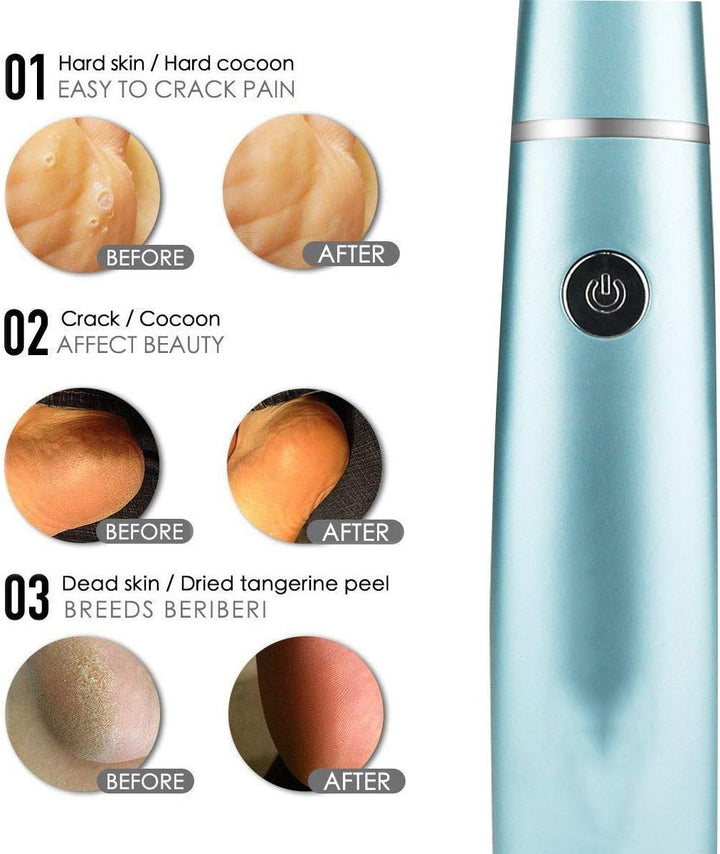 Gros plan sur la tête exfoliante de la ponceuse électrique pour les pieds, efficacité anti-callosités.