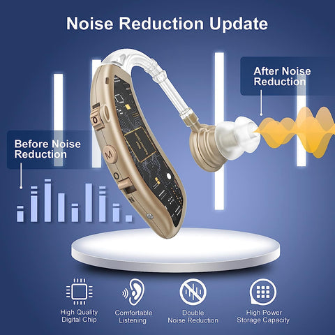 Amplificateur auditif numérique rechargeable, réduction de bruit avancée pour une écoute nette.