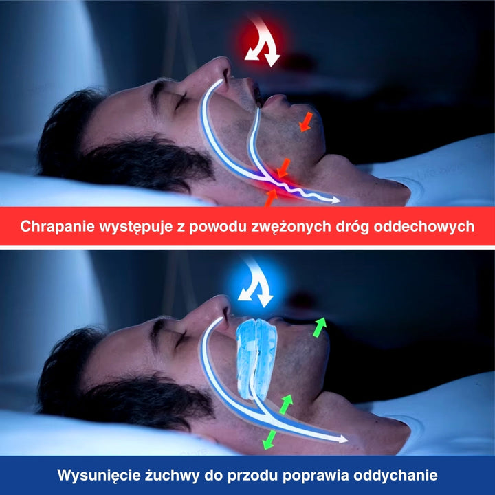 Femme avec écarteur nasal ajustable, favorisant le confort respiratoire et la santé du sommeil.