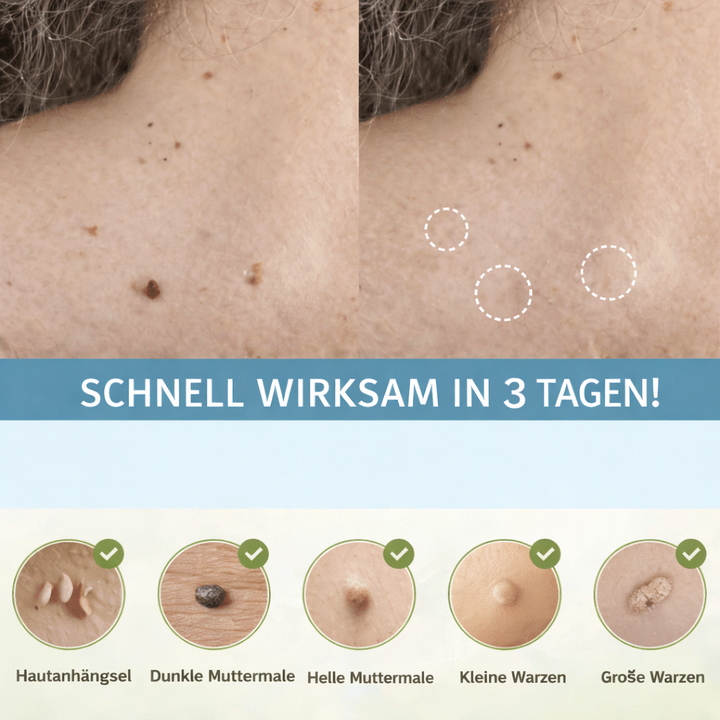 Patchs beauté femme, éliminant efficacement et sans douleur mollettes & étiquettes cutanées. Soin visage et corps.