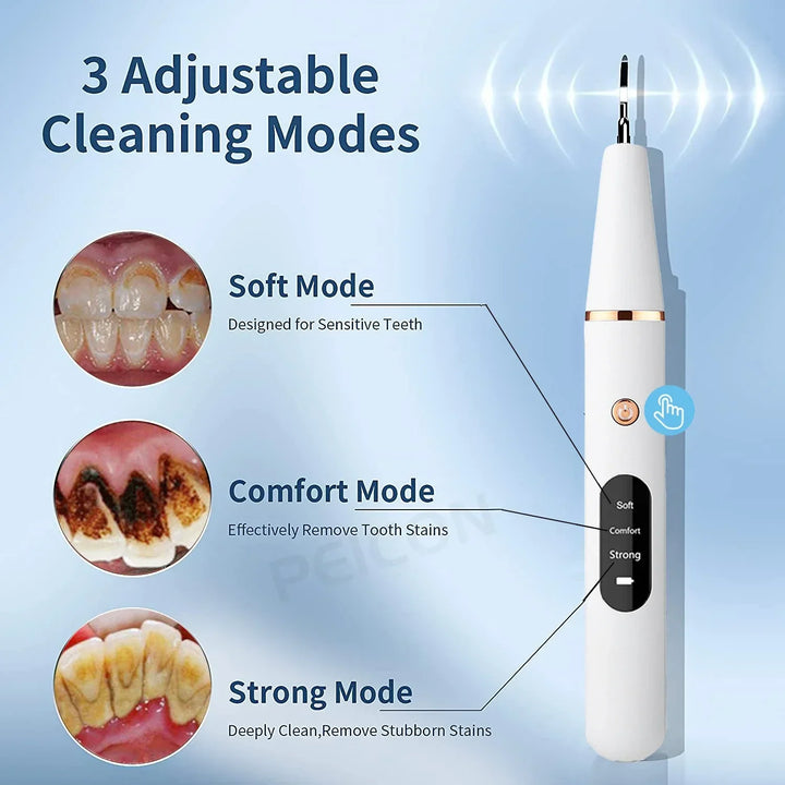 Design ergonomique de la brosse à dents ultrasonique, pour un nettoyage dentaire confortable et efficace.