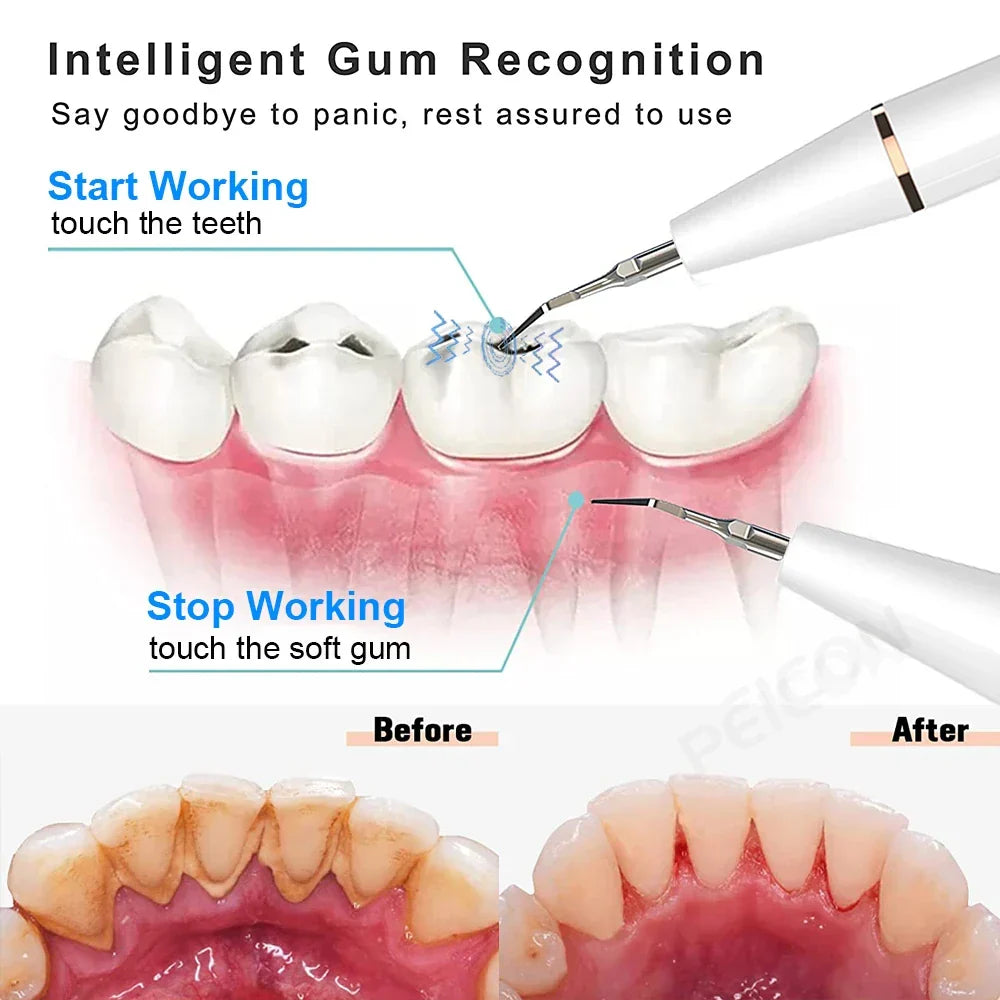Utilisation facile de la brosse à dents ultrasonique pour des soins dentaires quotidiens, hygiène buccale parfaite.