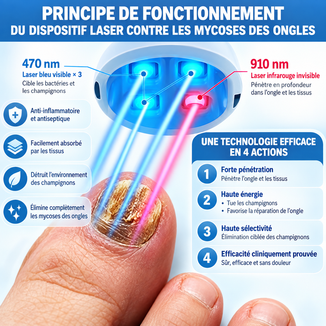 Dispositif laser pour ongles sains, améliore la beauté et l'hygiène des ongles avec lumière bleue.