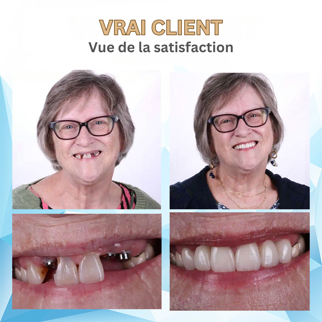 Bikenda : confort et sourire pour adultes. Prothèse dentaire en silicone pour une confiance retrouvée.