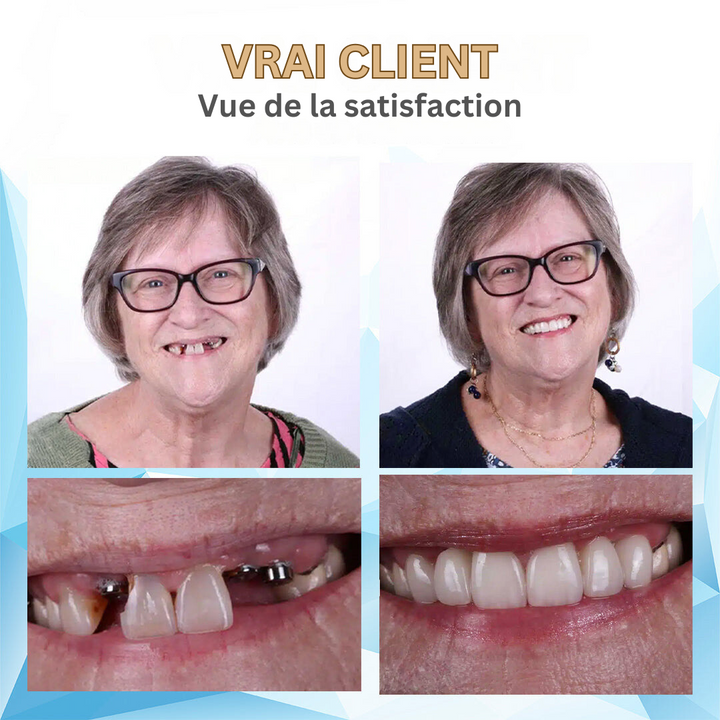 Bikenda : confort et sourire pour adultes. Prothèse dentaire en silicone pour une confiance retrouvée.