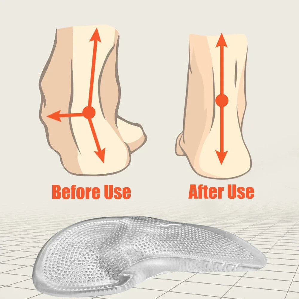 Semelles anti-douleur en silicone pour un amorti supérieur, idéales pour longues marches et pieds fatigués.