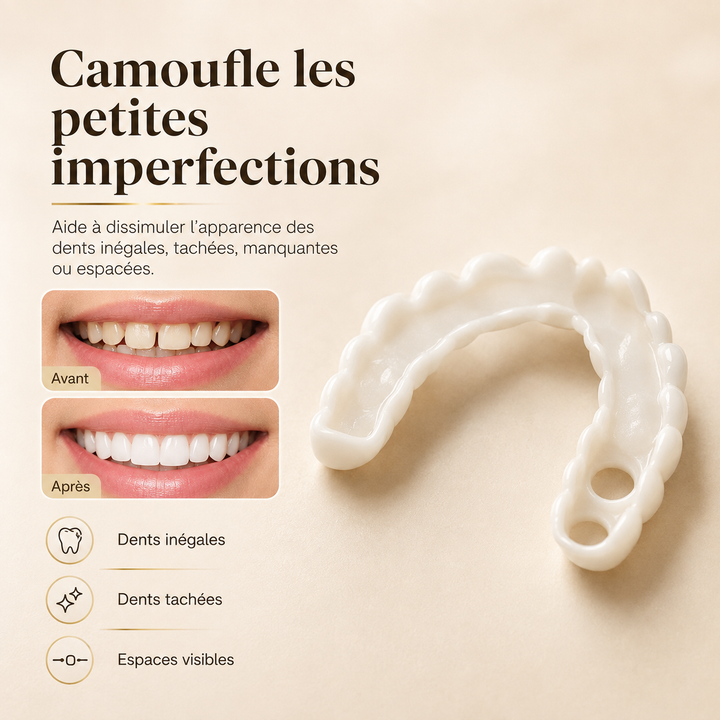 Solution pratique de facettes dentaires amovibles pour un sourire parfait et esthétique à tout moment.