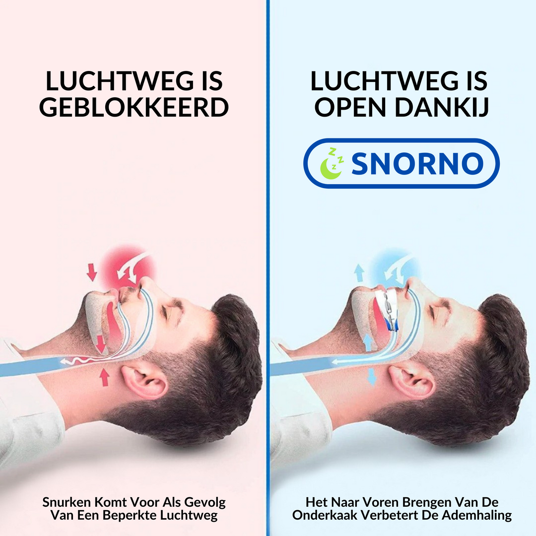 Gros plan sur le dispositif anti-ronflement, montrant son design pratique et ses matériaux sûrs.