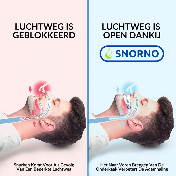 Gros plan sur le dispositif anti-ronflement, montrant son design pratique et ses matériaux sûrs.