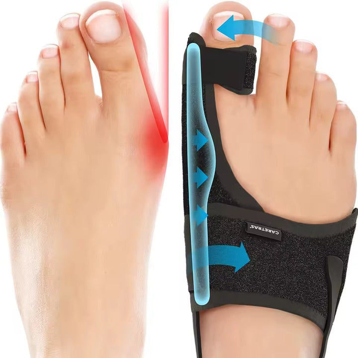 Attelle orteil Hallux Valgus facile à utiliser, ajustable et souple, procurant un confort nocturne pour le soin du pied.