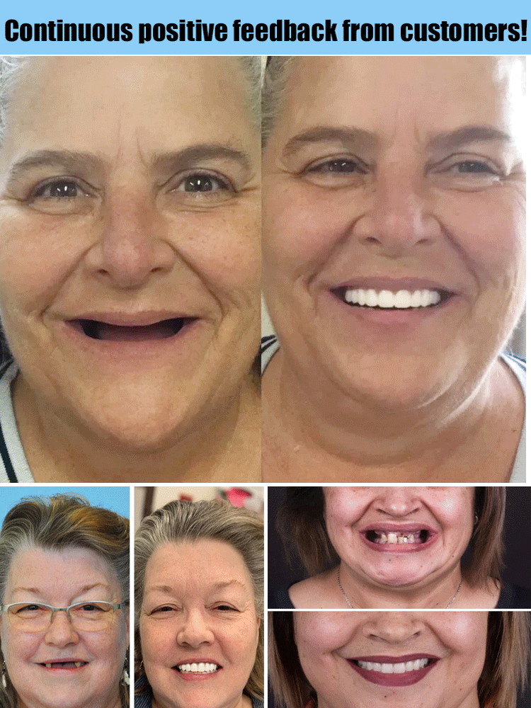 Prothèse dentaire cosmétique réutilisable, offrant un sourire éclatant et un confort durable.