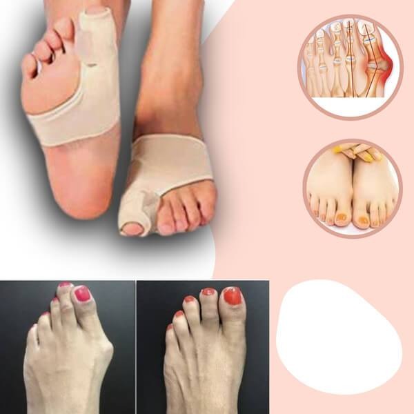 Correcteur unisexe d'hallux valgus pour soulager la douleur des oignons. Réaligne les orteils, apporte confort et protection.