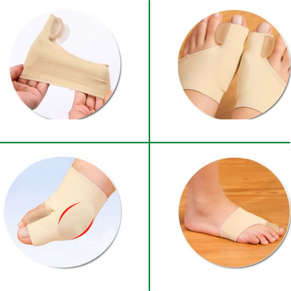 Correcteur d'oignon unisexe pour hallux valgus. Offre un soulagement efficace de la douleur et un réalignement doux des orteils.