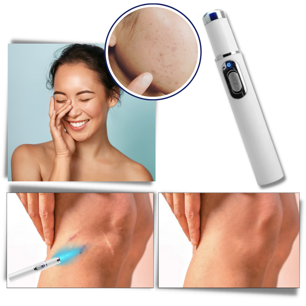 Appareil DermaPure de thérapie laser portable pour le visage, idéal soin anti-taches et cicatrices.