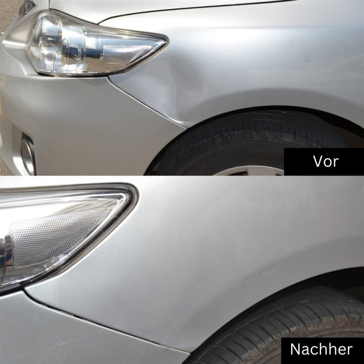 Kit d'entretien automobile pour débosselage sans peinture, répare efficacement les bosses de carrosserie.