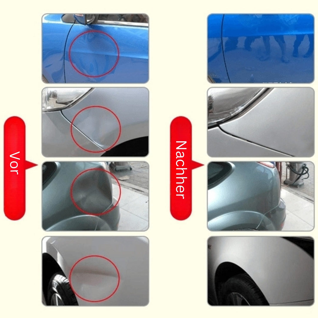 Réparez votre carrosserie avec ce kit de débosselage sans peinture. Élimine bosses et enfoncements.