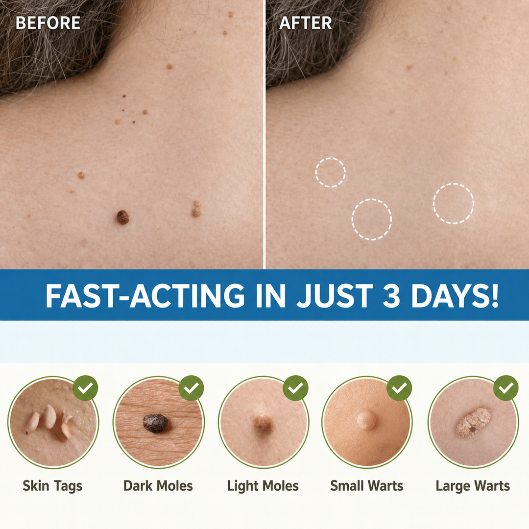 Solution naturelle et sûre: ces patchs éliminent les acrochordons sans douleur. Pour une peau nette et saine.