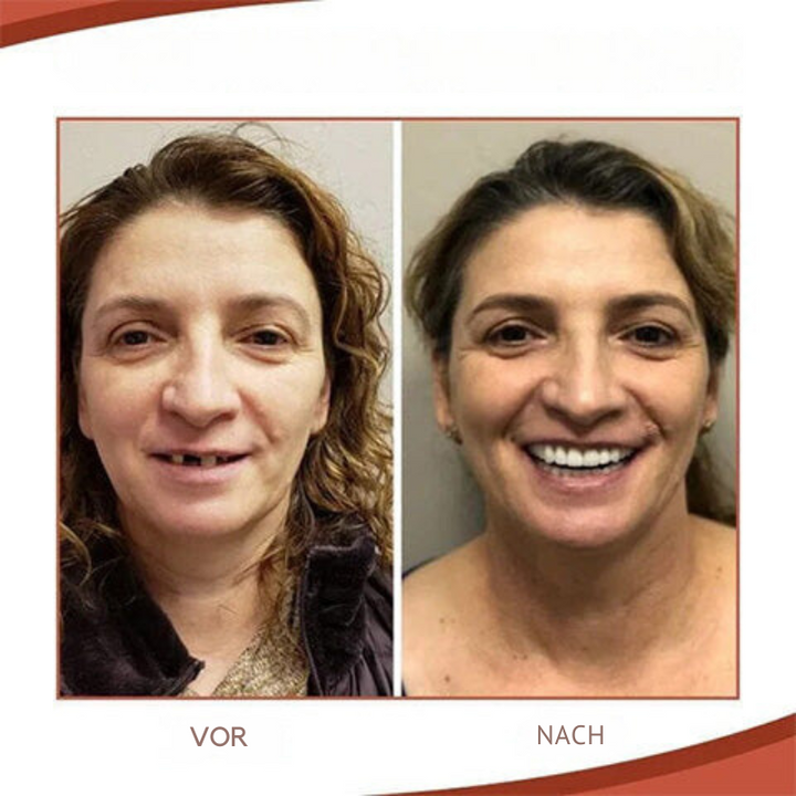 Solution d'ajustement personnalisable pour dentier, conçue pour hommes et femmes recherchant confort durable.