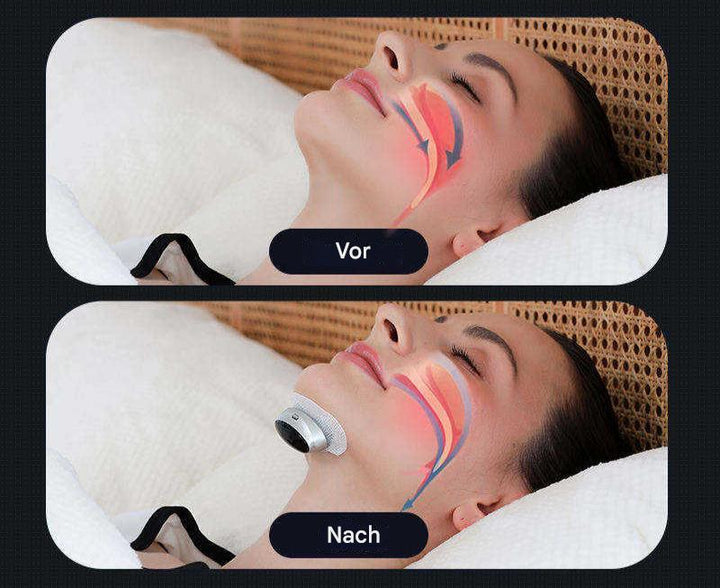 Portez AirEase pour un sommeil sans ronflement et une meilleure santé respiratoire. Simple d'utilisation et efficace.