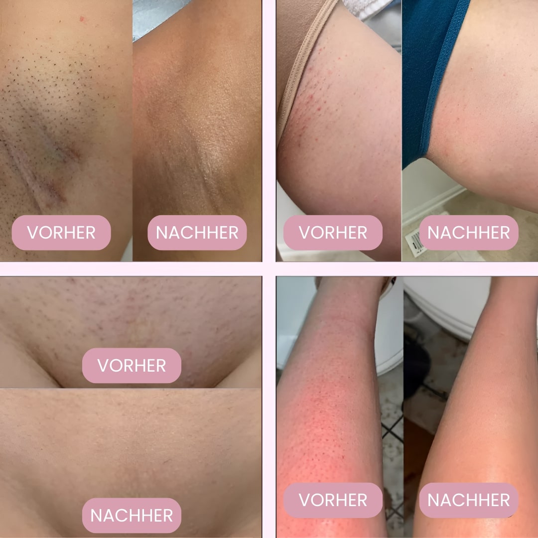 Rasoir électrique pour femmes, idéal peau sensible, épilation intime sans irritation, précision impeccable.