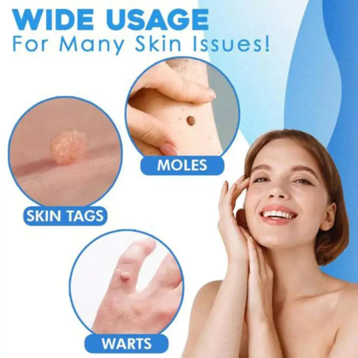 Solution dermatologique pour le traitement des acrochordons à domicile, simple et efficace.