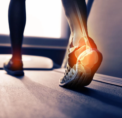 Bande de soutien FootFlex prévenant la douleur au pied. Essentielle pour le sport et le confort orthopédique au quotidien.