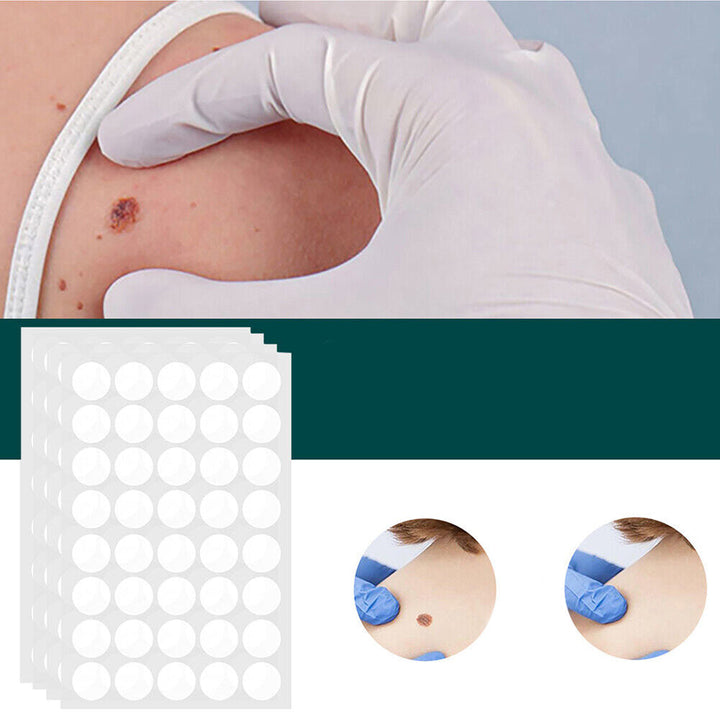 Patchs discrets pour l'élimination indolore des verrues et taches cutanées. Soin dermatologique efficace pour la peau.