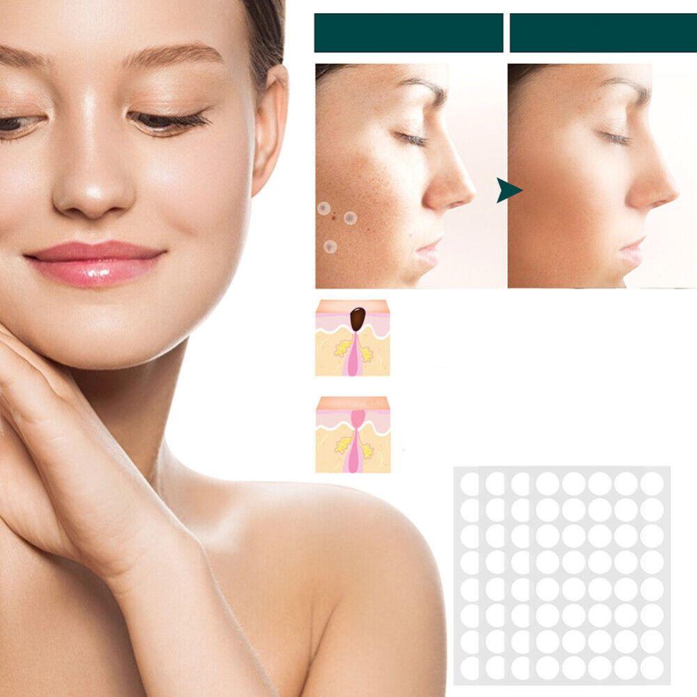Soin dermatologique avancé : patchs pour éliminer verrues et taches, restaurant la beauté naturelle de votre peau.