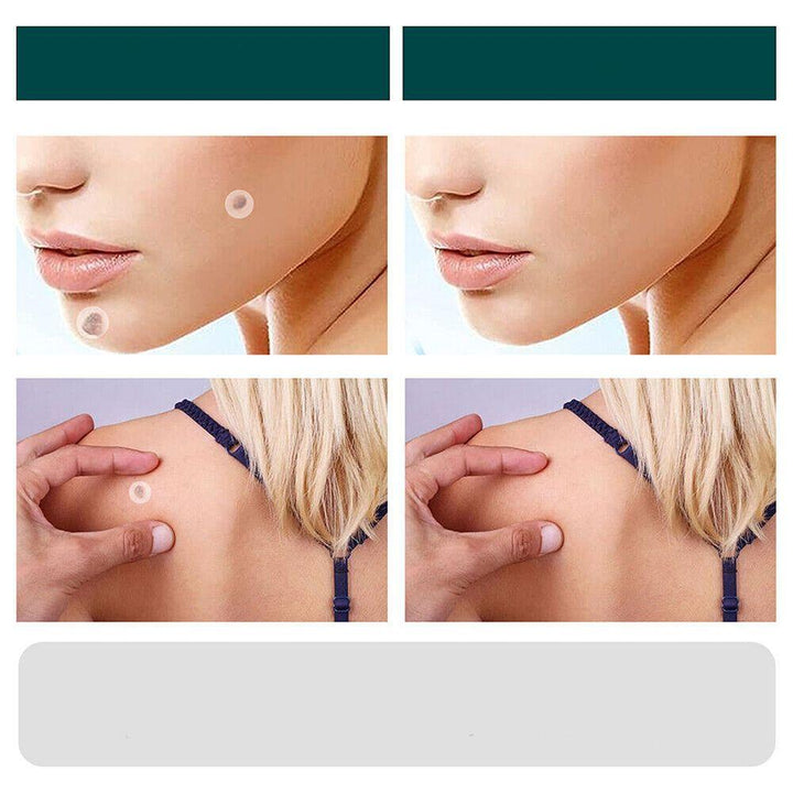 Patchs innovants pour l'élimination ciblée des verrues et taches. Solution discrète et douce pour la peau sans imperfections.